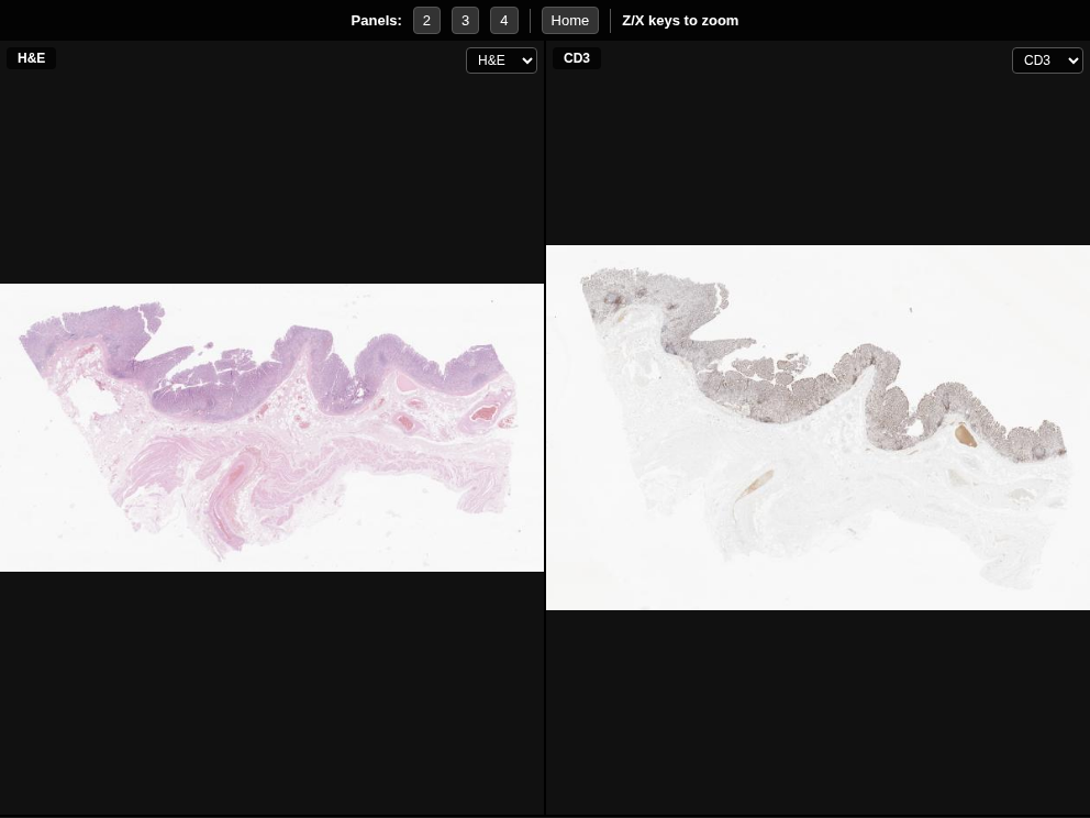 Click for Full Screen WSI